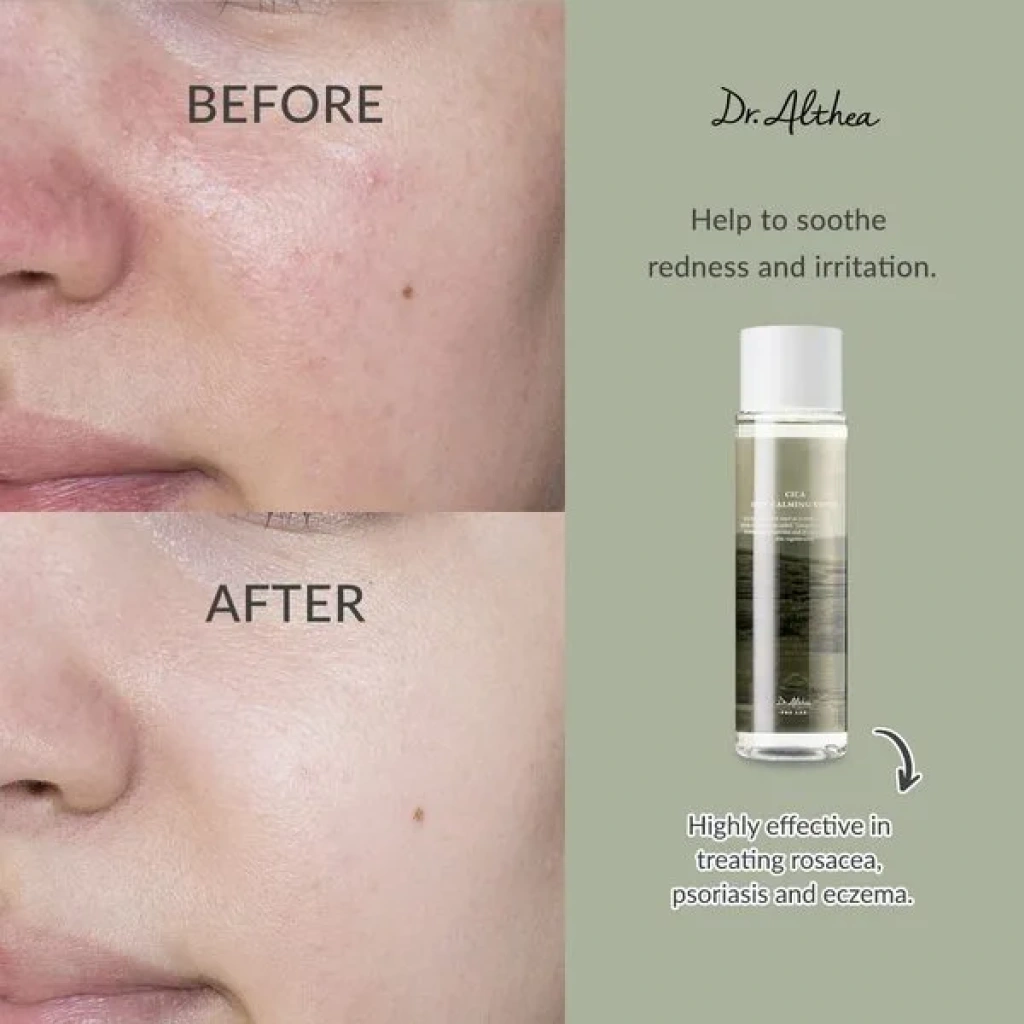 Dr. Althea Anastatica Skin Conditioning Toner 250ml – Image 3