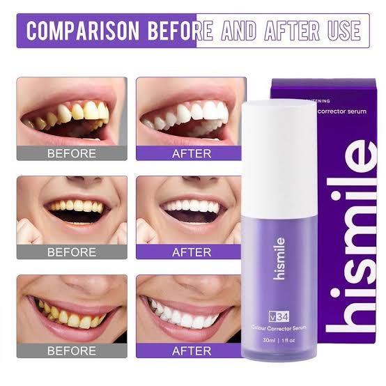 Hismile - V34 Colour Corrector Serum – Image 3