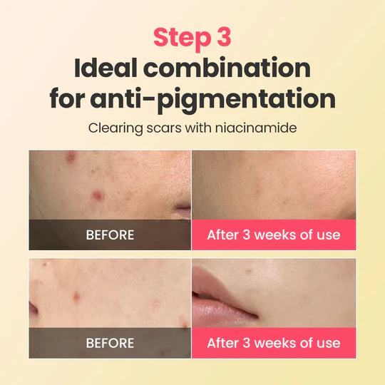 Dr.G R.E.D Blemish Repair Soothing Cream Holiday Special 50ml – Image 3