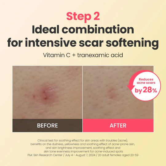 Dr.G R.E.D Blemish Repair Soothing Cream Holiday Special 50ml – Image 5