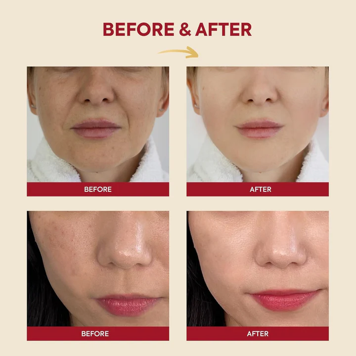 K-SECRET SEOUL 1988 Essence Snail Mucin 97% + Rice 100ml – Image 3